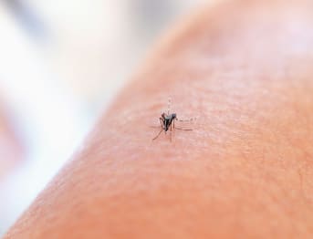 Consigli per prevenire e alleviare le punture di insetti in estate