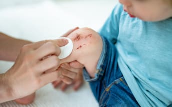 Comment apaiser naturellement une plaie ouverte ? 